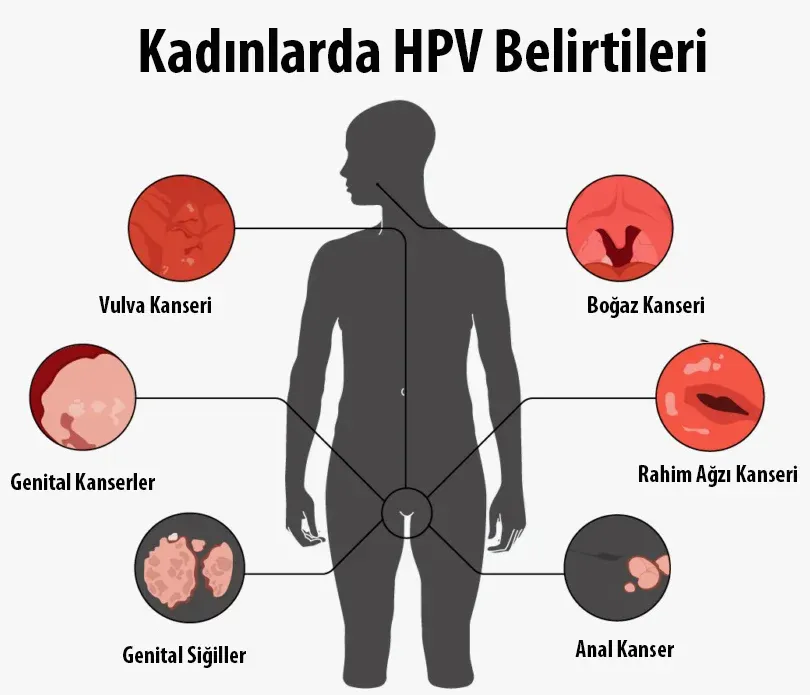 Kadınlarda HPV ve HPV Belirtileri