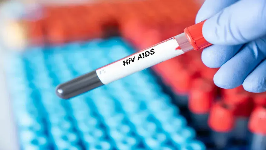 AIDS ve HIV Nedir ? Erken Teşhisin Önemi ve Tedavi Yöntemleri